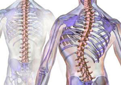 Myths About Scoliosis Blog Post Utah Physical Therapy